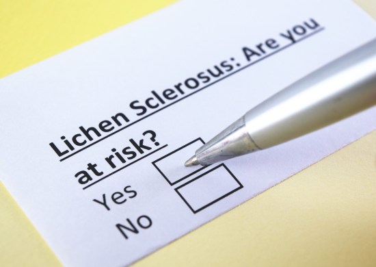 lichen sclerosus
